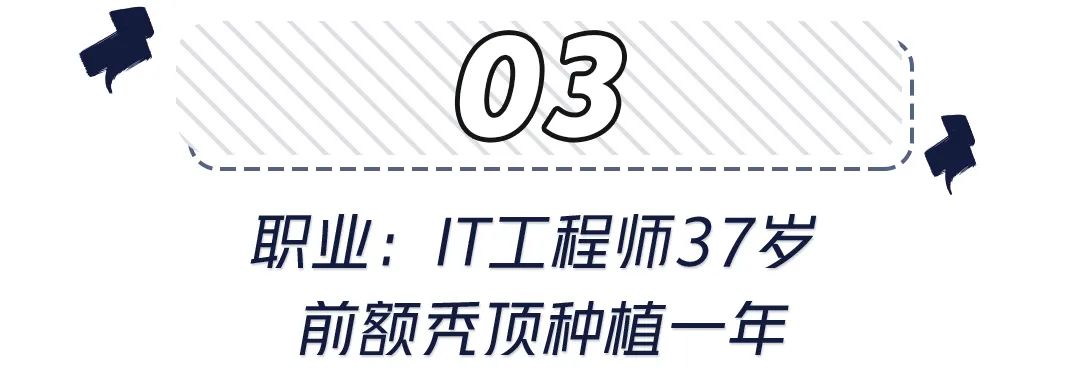 前额头发秃面相 世界里没有容易二字，除了发胖还可能是元凶！