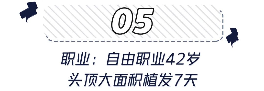 前额头发秃面相 世界里没有容易二字，除了发胖还可能是元凶！