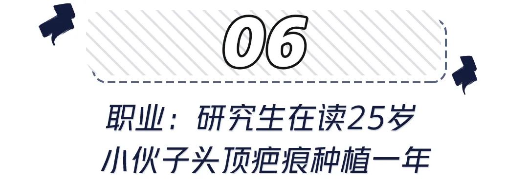 前额头发秃面相 世界里没有容易二字，除了发胖还可能是元凶！