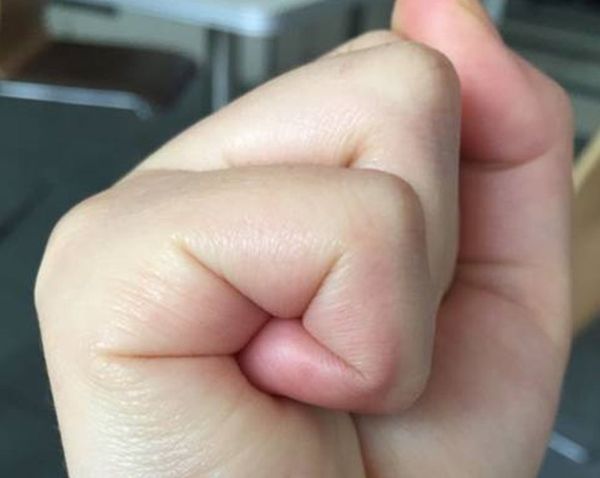 网传通过孕妇手纹可预知胎儿性别右手看怎么看